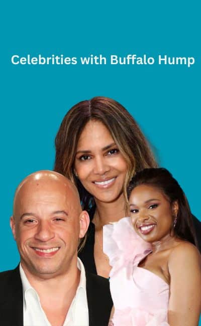 celebrities with buffalo hump title=