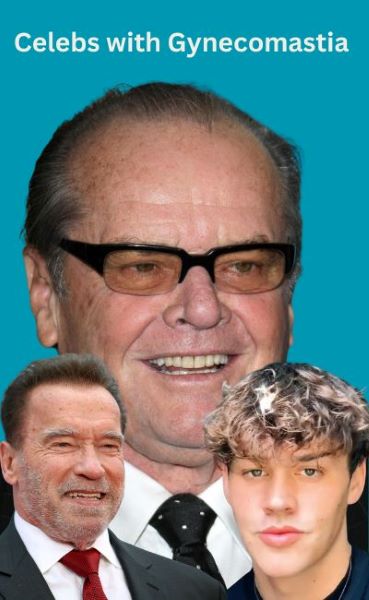 celebs with gynecomastia title=