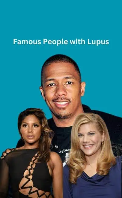 celebrities with lupus title=
